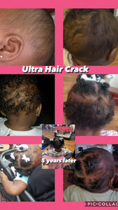 The Ultra Hair Crack